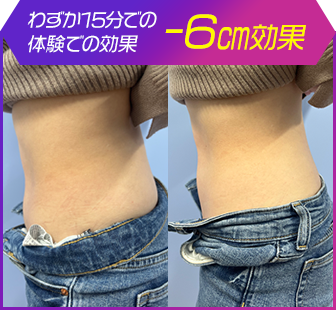 ボディ施術例02