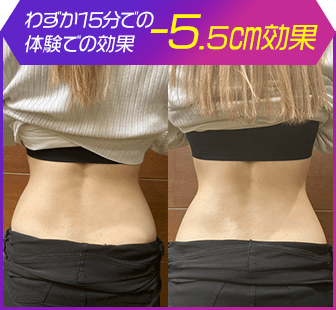 ボディ施術例05