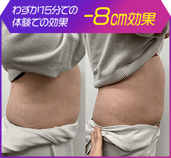 ボディ施術例07