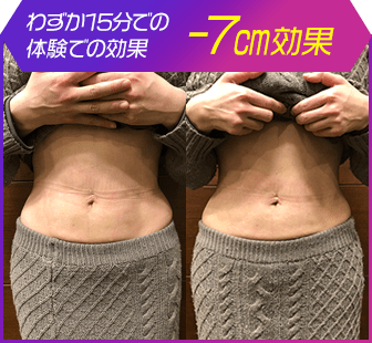 ボディ施術例08