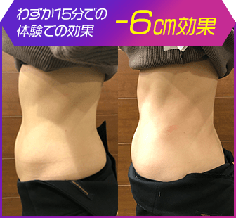 ボディ施術例09