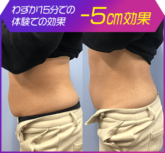 ボディ施術例12