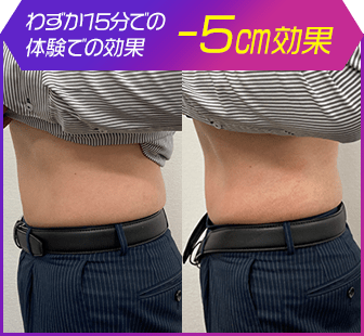 ボディ施術例14