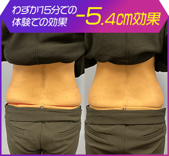 ボディ施術例16