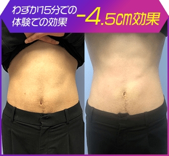 ボディ施術例20