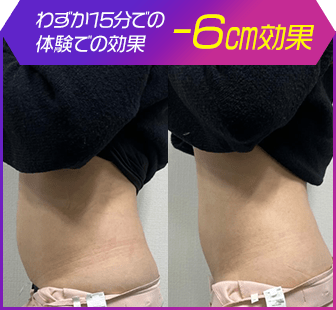 ボディ施術例21