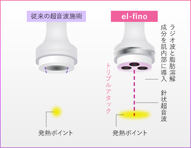 新技術SMN（ソニックメソニードル）理論搭載で複数のトリートメントを同時施術！