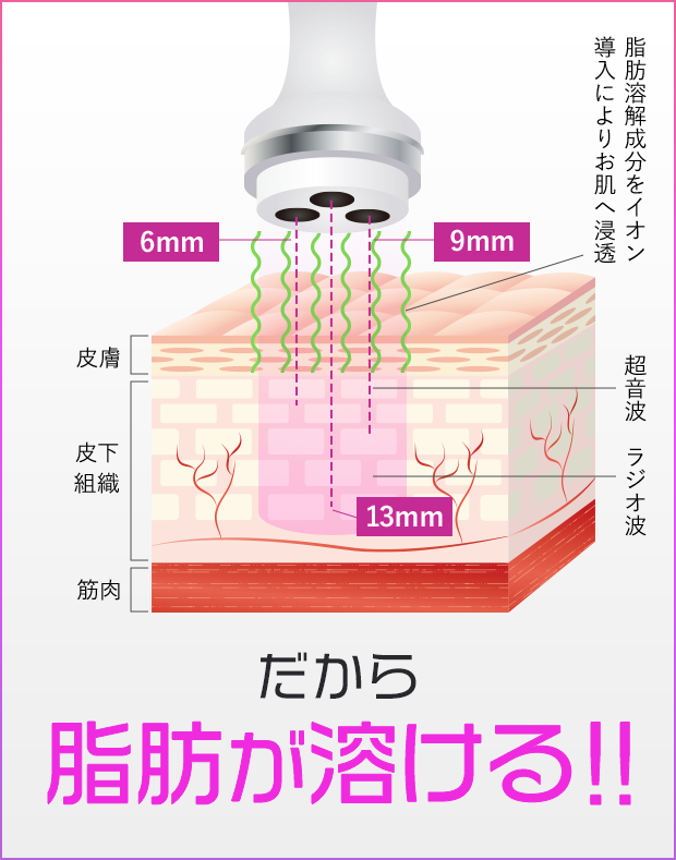 激スゴポイント!!