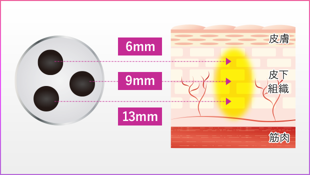 激スゴポイント!!